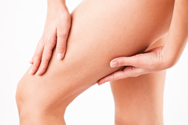 What Causes Cellulite On Legs And Thighs?