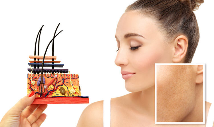 Post Inflammatory Hyperpigmentation: What Is It And How To Treat