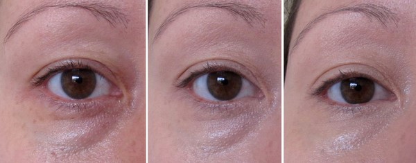 Bobbi Brown Before and After Pictures