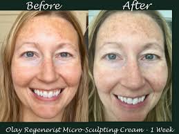 olay regenerist micro-sculpting cream Before and After Pictures